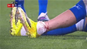 Gabriel Pec foi lesionado por Victor Gabriel, do Inter